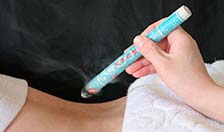 moxibustion
